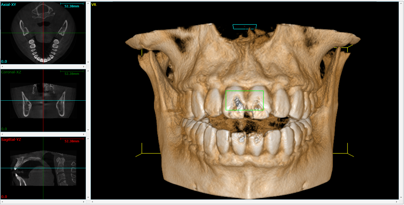 Cone Beam 3D Imaging Livingston, TX